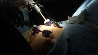 Gastric Bypass Recovery: What You Need to Know for Success
