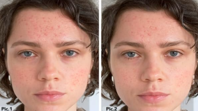 LED Face Mask Before and After: Transform Your Skin with the LED Face and Neck Mask