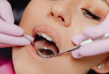 How Lifestyle Coaching Has Become Part Of Cosmetic Dentistry