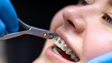 7 Measurements Orthodontists Use To Evaluate Treatment Progress