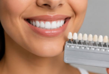 6 Questions To Ask When Comparing Repair Options For A Visible Tooth