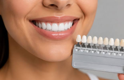 6 Questions To Ask When Comparing Repair Options For A Visible Tooth