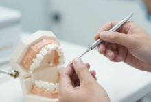 5 Ways Cosmetic Dentistry Can Be Conservative And Tooth Sparing