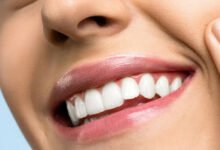 Modern Approaches To Refreshing Smiles After Years Of Dental Work